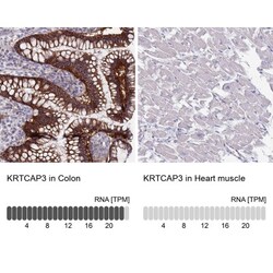 KRTCAP3 Antibody, Novus Biologicals 0.1mL; Unlabeled:Antibodies, Polyclonal